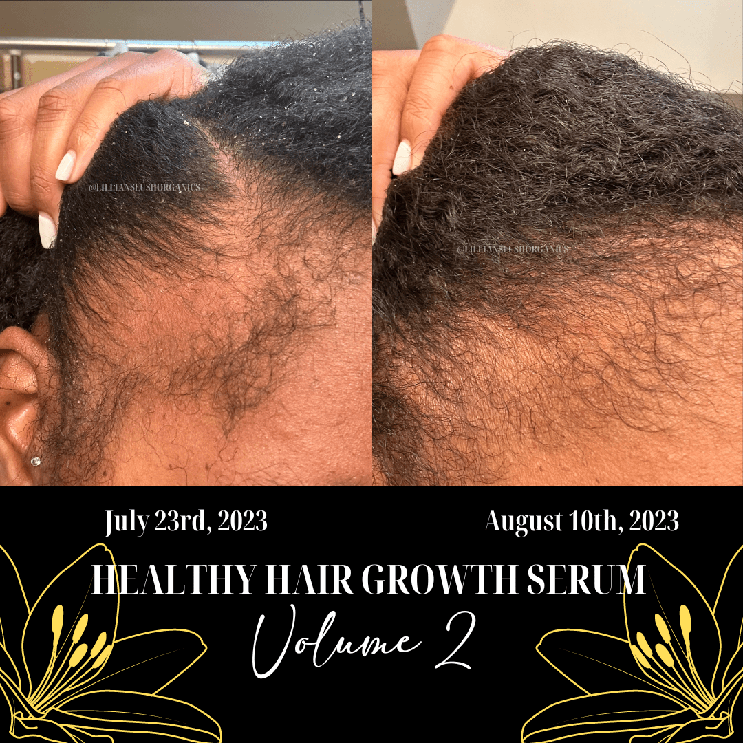 Healthy Hair Growth Serum Volume 2