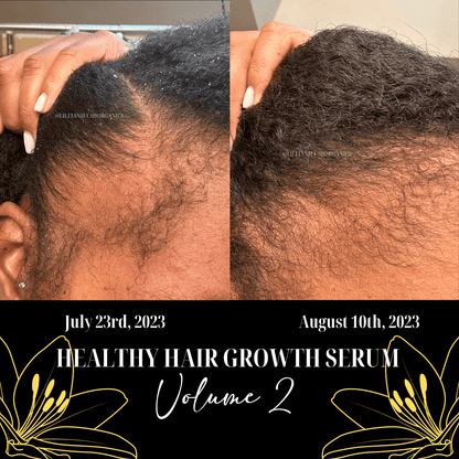 Sérum pour une croissance saine des cheveux VOLUME 2