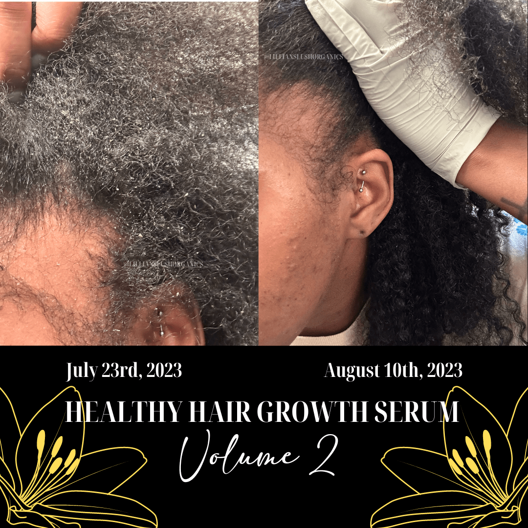 Healthy Hair Growth Serum VOLUME 2