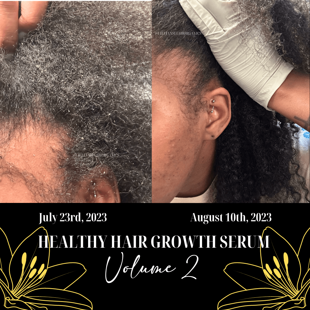 Healthy Hair Growth Serum Volume 2